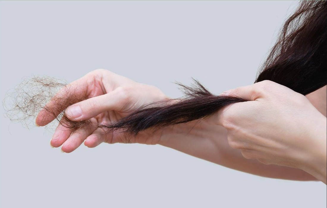 Các nguyên nhân dẫn đến rụng tóc