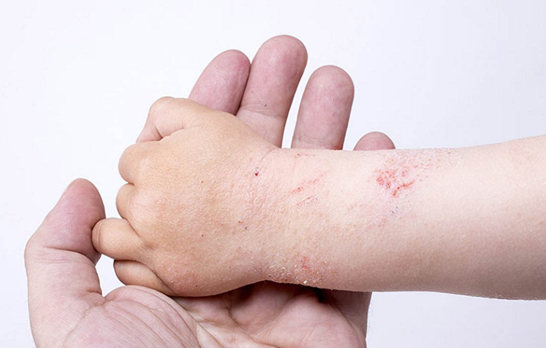 Cuối cùng thì con mình cũng được ngon giấc